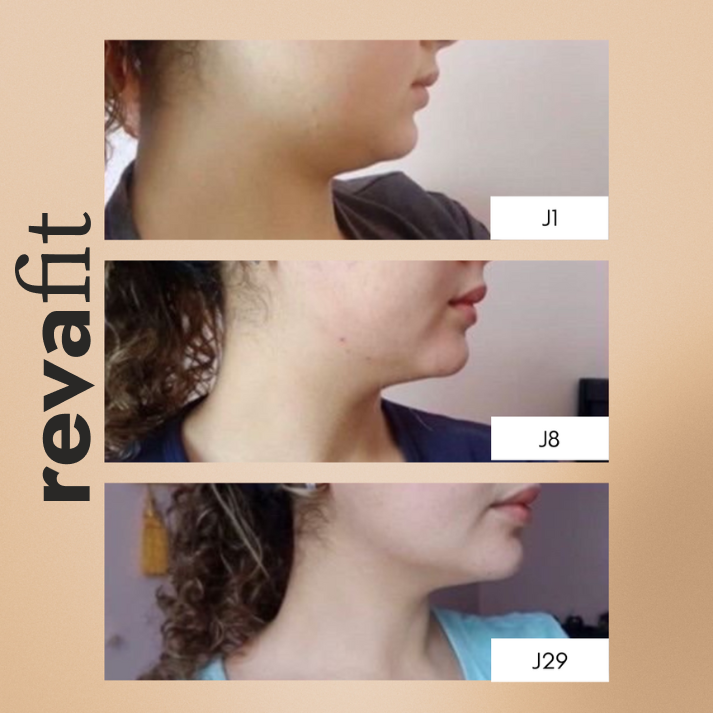 Kit Expert Minceur Visage