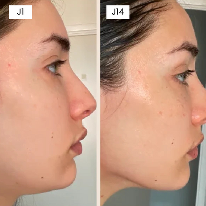 Kit Expert Minceur Visage